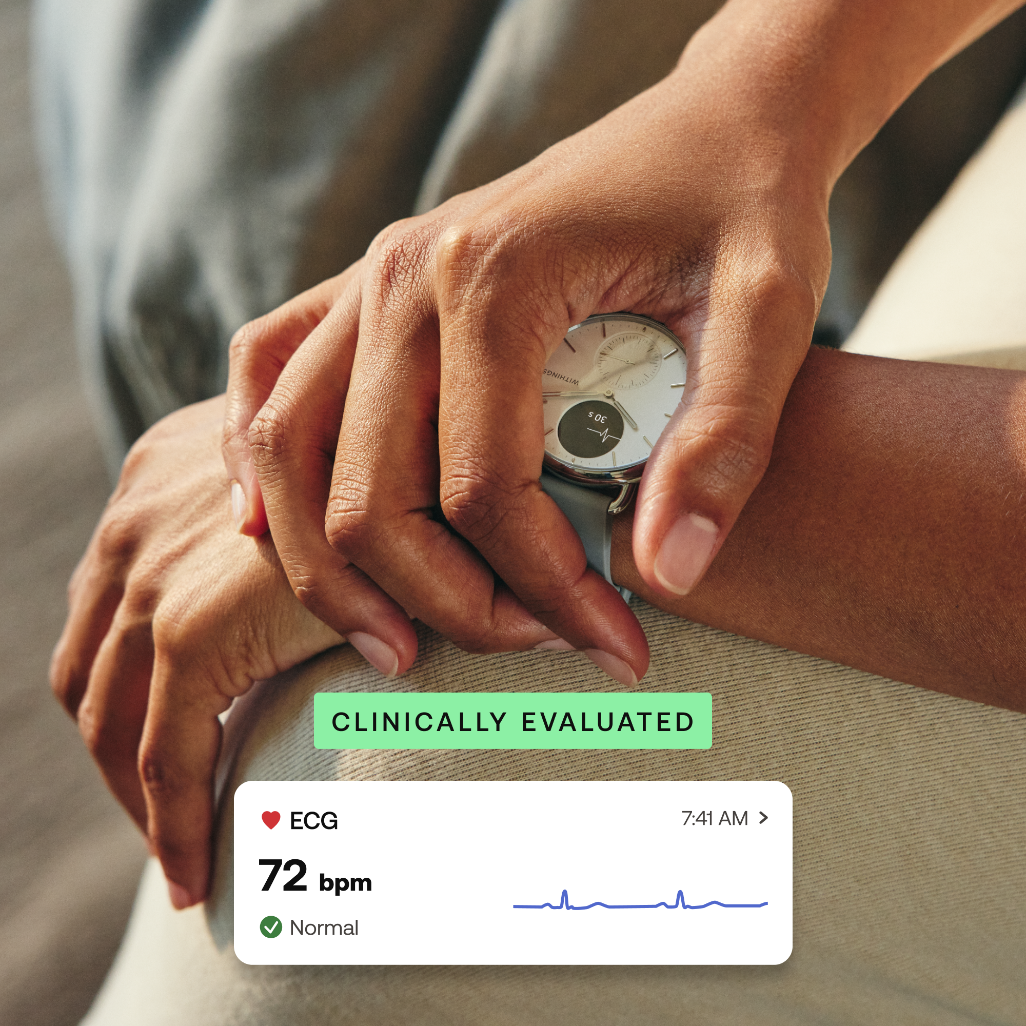 Pametni sat WITHINGS ScanWatch 2 41mm bijeli-4