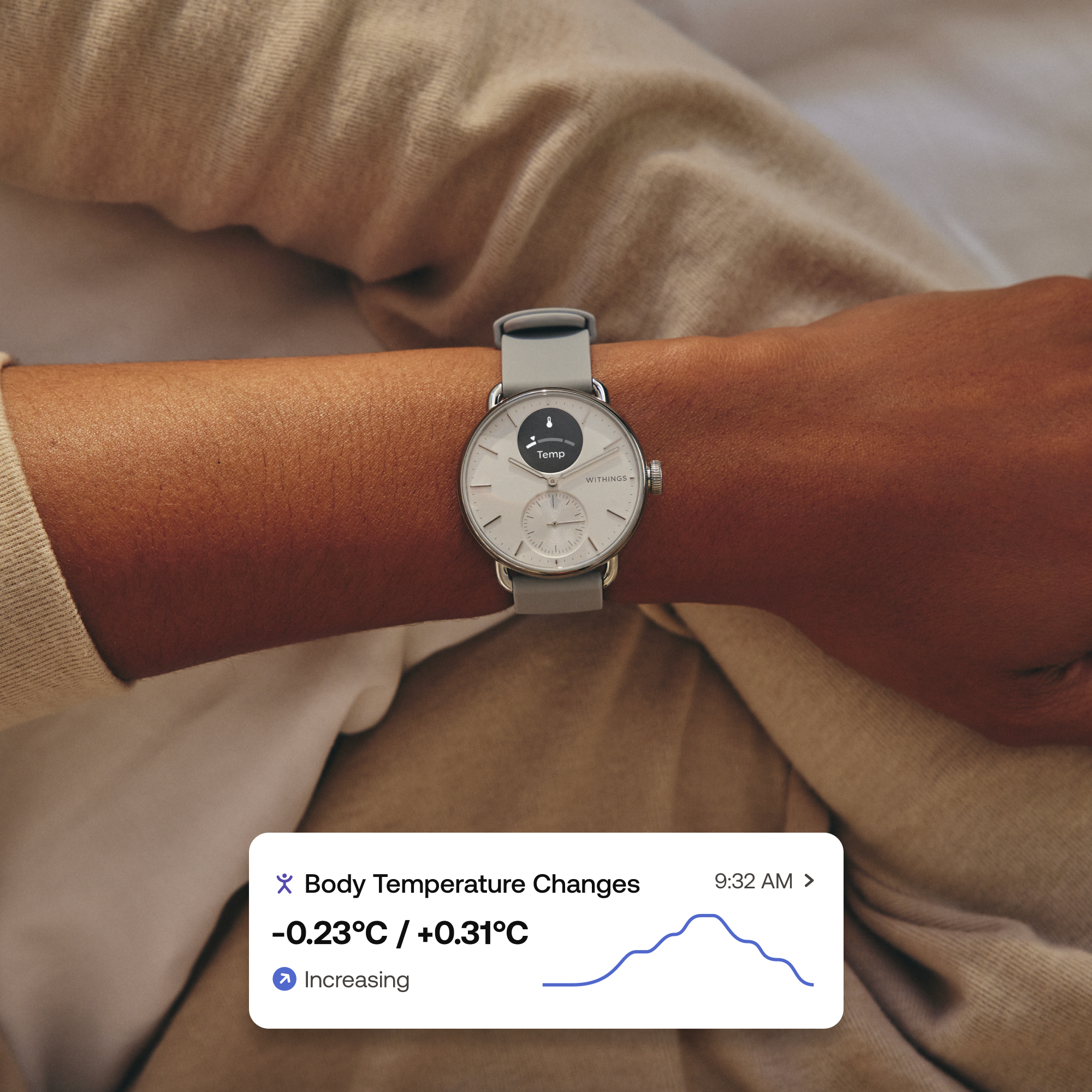 Pametni sat WITHINGS ScanWatch 2 41mm bijeli-6