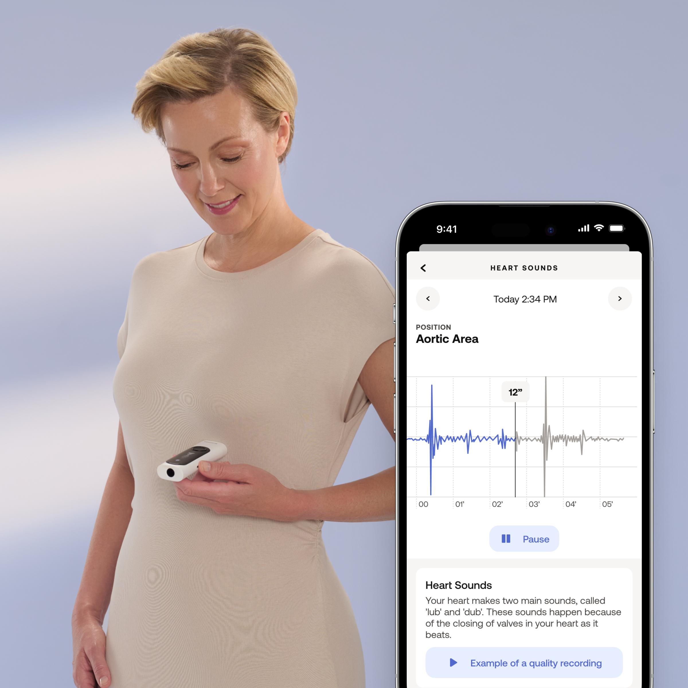 Uređaj za zdravlje WITHINGS 4-in-1 health MultiScan bijeli-2